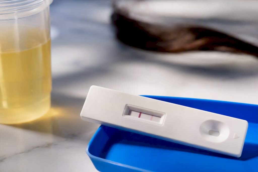 Urine test strip showing faint second line
