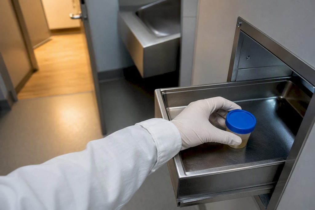 Anonymous urine specimen entering laboratory tray